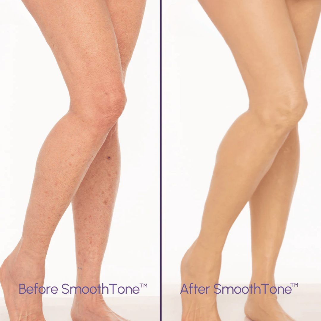 SmoothTone Body Concealer